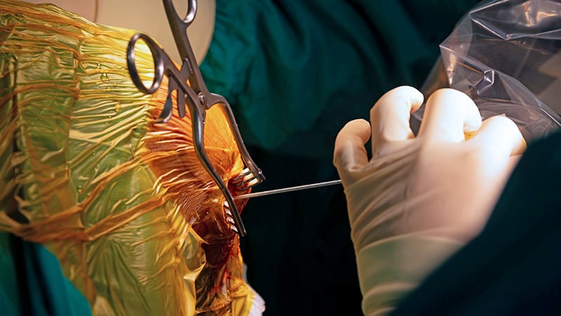 بیوپسی قشر پیش‌پیشانی در جریان تحریک عمیق مغز ایمن است