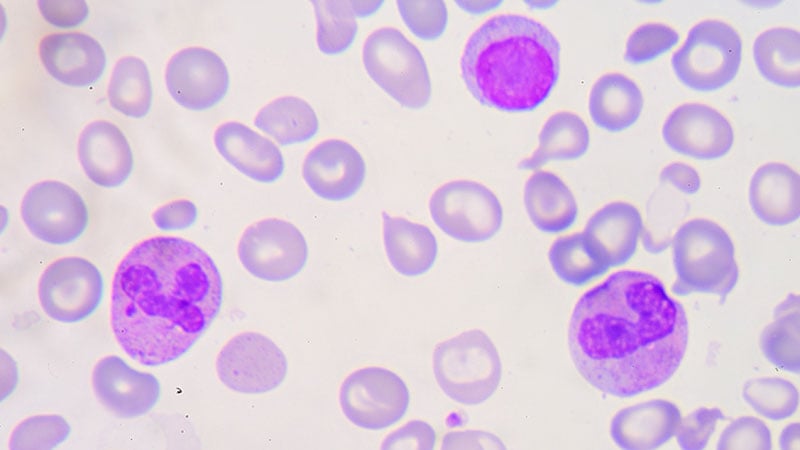 بتا تالاسمی: ویرایش ژنتیکی کیفیت زندگی را بهبود می‌بخشد